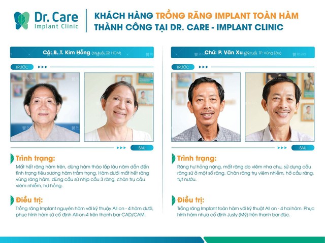 Nha khoa chuyên sâu trồng răng Implant tại TP.HCM - Ảnh 3. Nha khoa chuyên sâu trồng răng Implant tại TP.HCM - Ảnh 3.